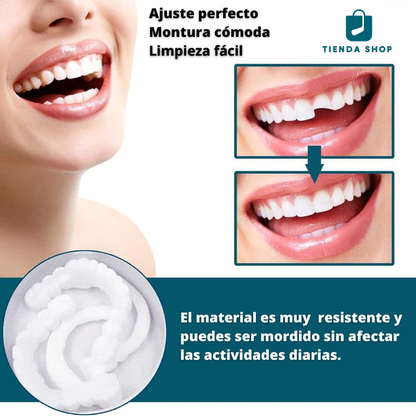 Carillas Dentales De Resina Ajustables