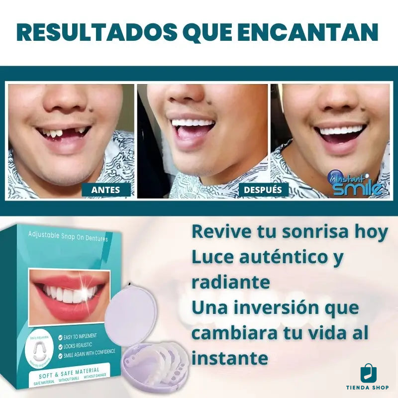 Carillas Dentales De Resina Ajustables