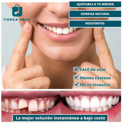 Carillas Dentales De Resina Ajustables